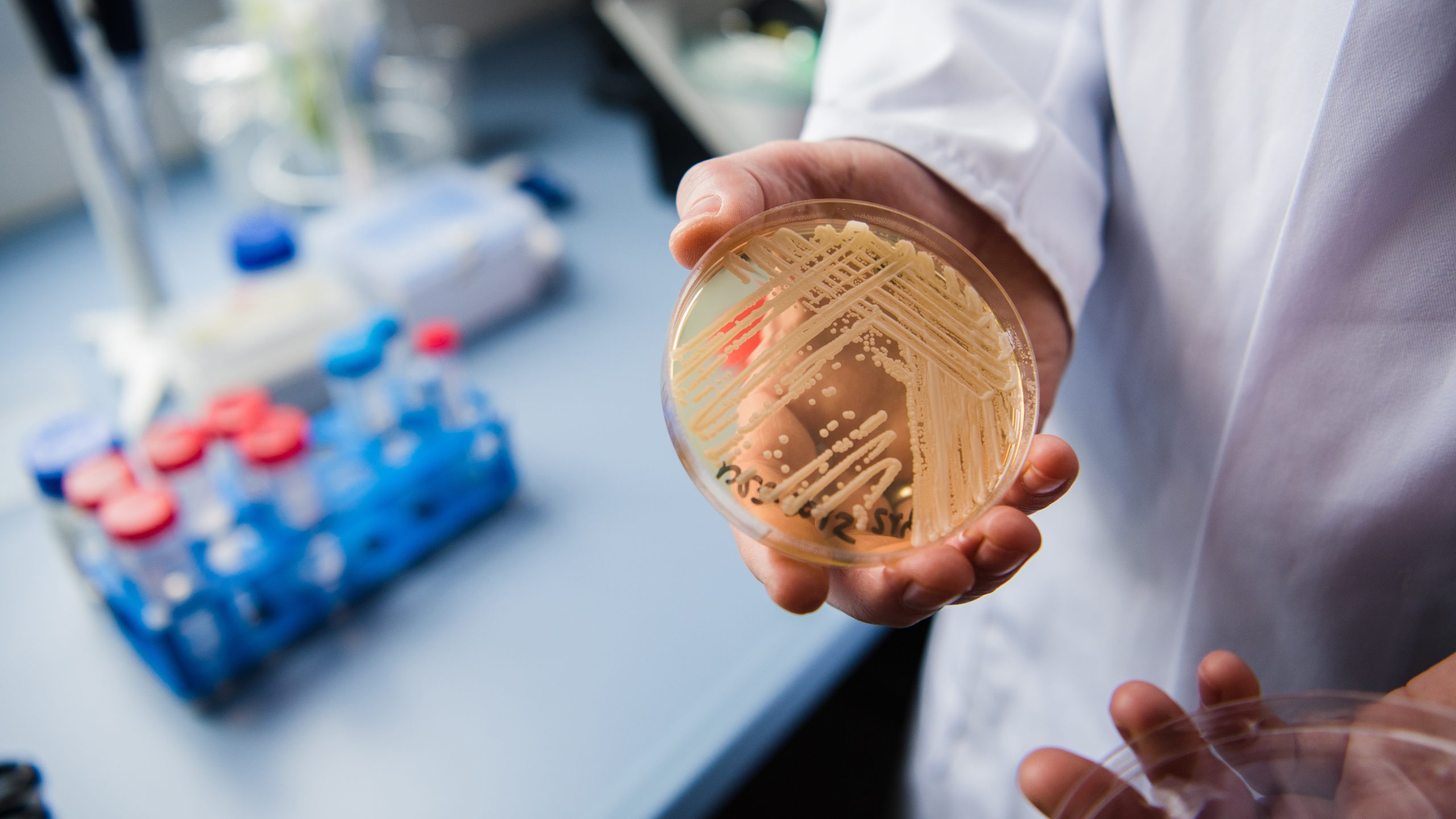 New study reveals why dangerous fungus is so difficult to treat — KTVU FOX 2 Bay Area, Los Altos Community news
